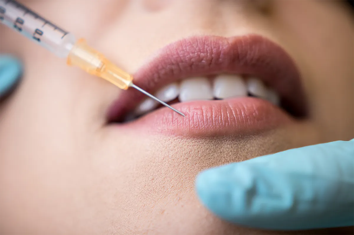 Injection d'acide hyaluronique à Montpellier